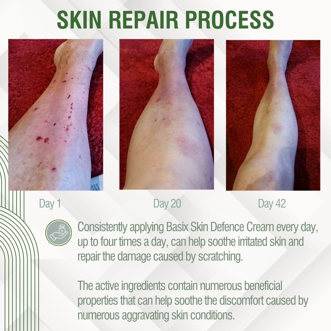 Basix Skin Defence Repair Cream for Seriously Dry Skin  - Twin Pack (2x50ml) - Lombardi Smith
