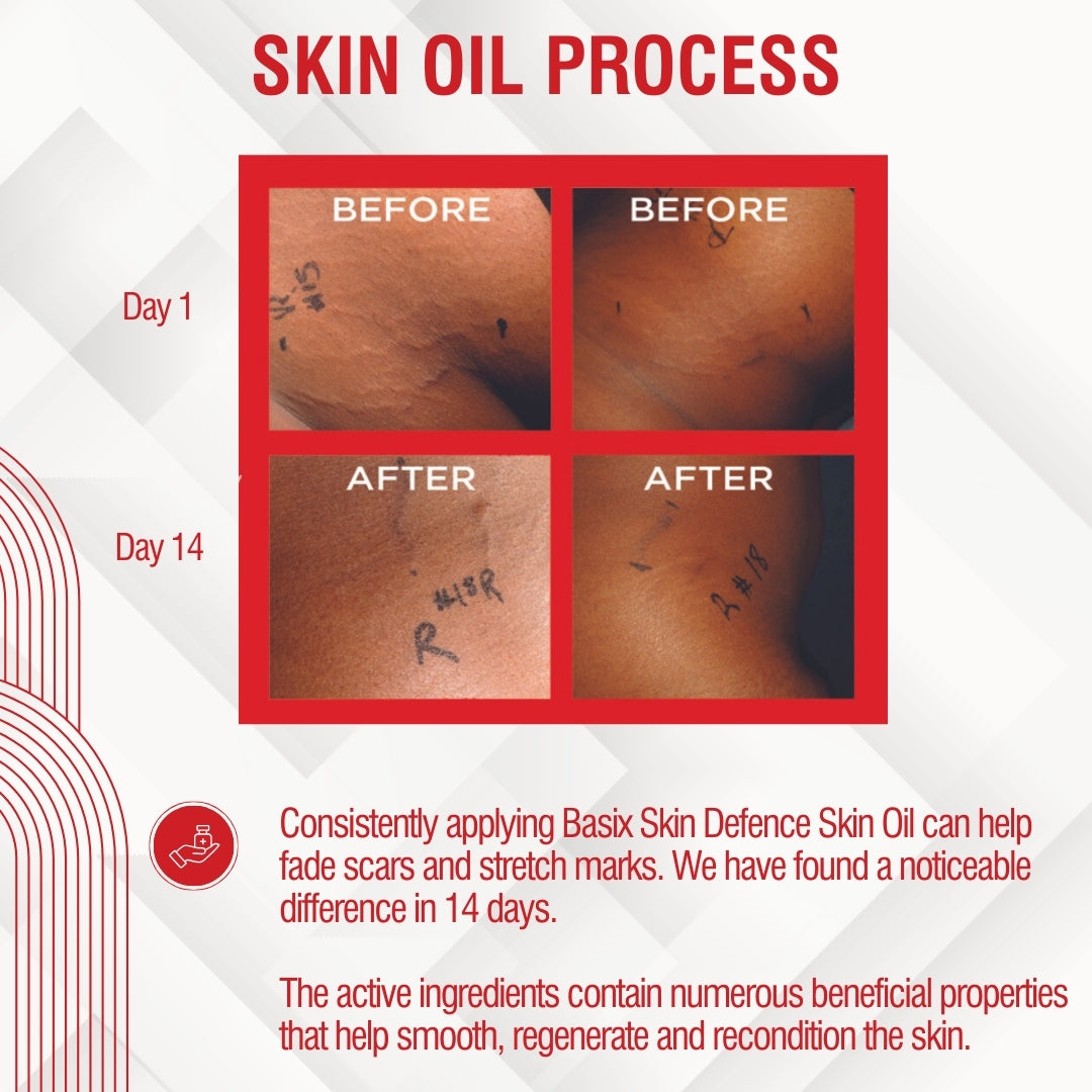 Clear Skin Oil - for Reducing Marks and Scars - 60ml - Lombardi Smith
